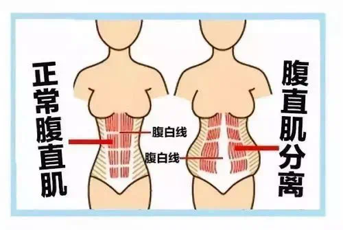 孕前小蠻腰，孕后似錢包？來看看解決辦法吧！
