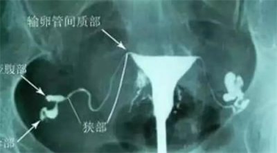 給高齡備孕女性的忠告：5個(gè)誤區(qū)，提前知道！